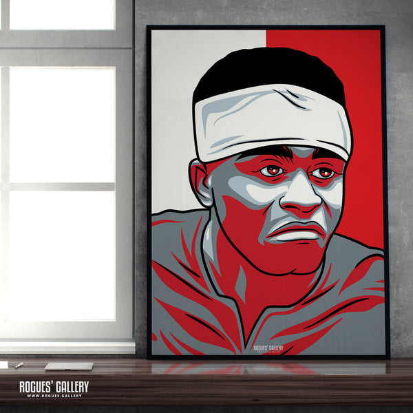 Bandaged Brice Samba - Nottingham Forest - A0, A1, A2 or A3 #GetBehindTheLads Icon Prints