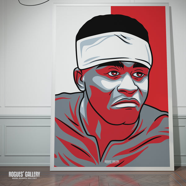 Bandaged Brice Samba - Nottingham Forest - A0, A1, A2 or A3 #GetBehindTheLads Icon Prints