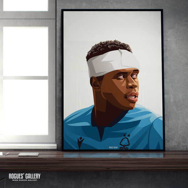 Bandaged Brice Samba - Nottingham Forest - Signed A3 Prints - 2 versions