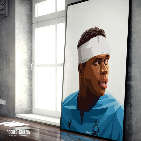 Bandaged Brice Samba - Nottingham Forest - Signed A3 Prints - 2 versions